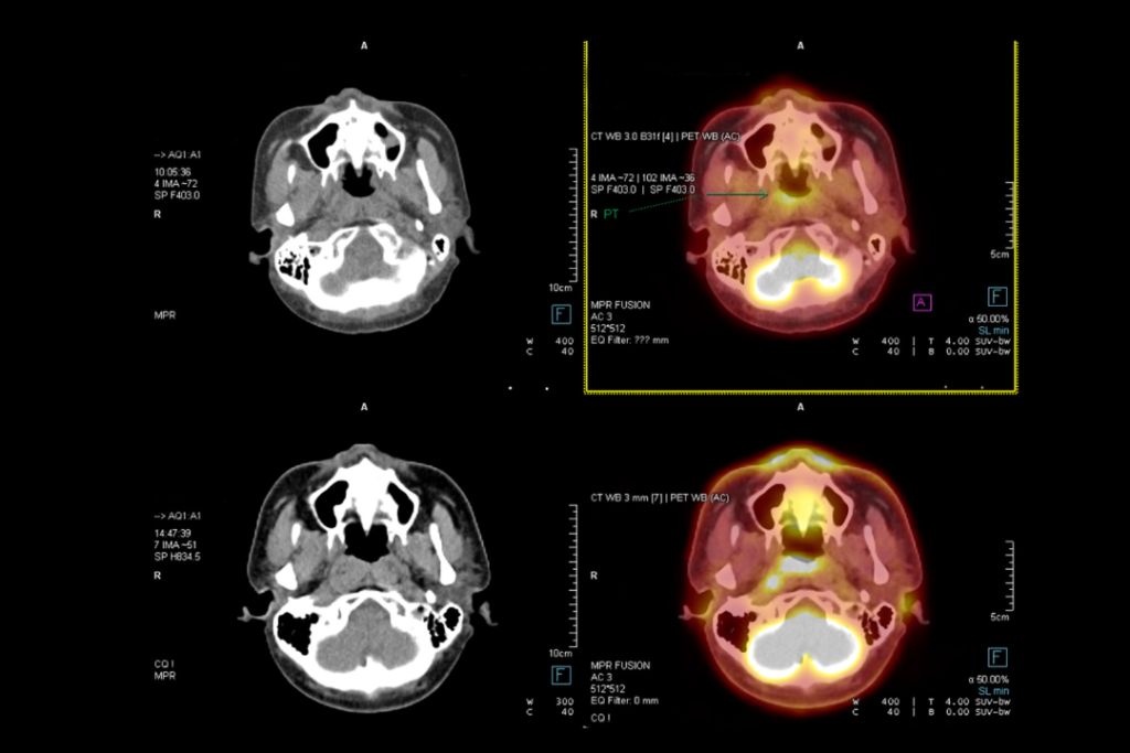 Procedimientos de medicina nuclear